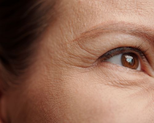 Close up of a woman's face with fine lines and wrinkles around the eyes
