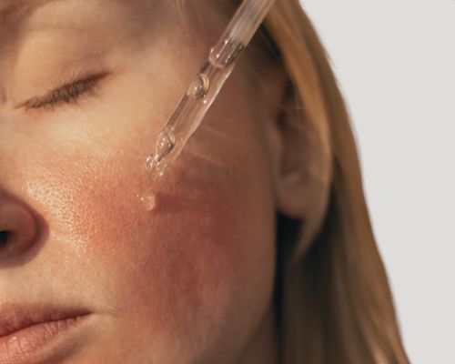 Woman's face with reactive skin, applying a clean serum to soothe the skin